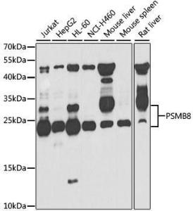 Western blot analysis of extracts of various cell lines, using Anti-Proteasome 20S LMP7 Antibody (A306732) at 1:1,000 dilution. The secondary antibody was Goat Anti-Rabbit IgG H&L Antibody (HRP) at 1:10,000 dilution.