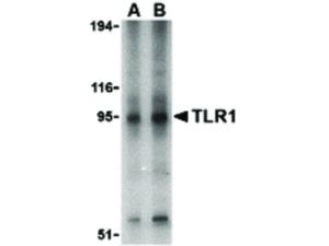 Anti-TLR1 Rabbit polyclonal antibody