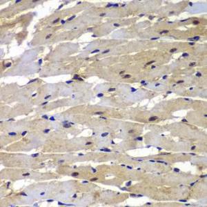 Immunohistochemistry analysis of paraffin-embedded rat heart using Anti-Proteasome 20S LMP7 Antibody (A306732) at a dilution of 1:100 (40x lens). Perform microwave antigen retrieval with 10 mM PBS buffer pH 7.2 before commencing with IHC staining protocol.