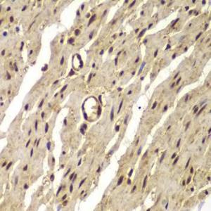 Immunohistochemistry analysis of paraffin-embedded human colon tissue using Anti-Proteasome 20S LMP7 Antibody (A306732) at a dilution of 1:100 (40x lens). Perform microwave antigen retrieval with 10 mM PBS buffer pH 7.2 before commencing with IHC staining protocol.
