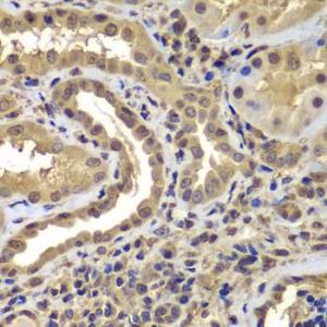 Immunohistochemistry analysis of paraffin-embedded human kidney using Anti-Proteasome 20S LMP7 Antibody (A306732) at a dilution of 1:100 (40x lens). Perform microwave antigen retrieval with 10 mM PBS buffer pH 7.2 before commencing with IHC staining protocol.