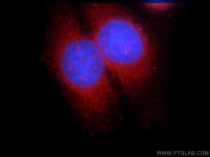 Anti-SNX9 Rabbit Polyclonal Antibody