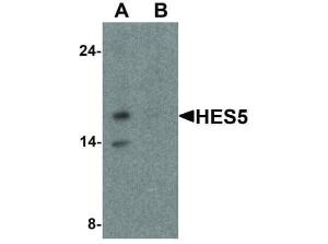 Anti-HES5 Rabbit polyclonal antibody