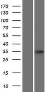 ATOH8 Lysate (Adult Normal), Novus Biologicals (NBP2-05965)