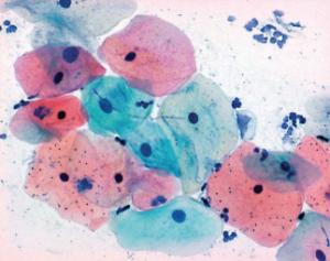 Papanicolaou's solution 3b polychromatic solution EA 50 used in nuclear staining, for cytology, Sigma-Aldrich®