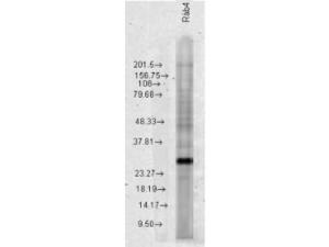 Anti-RAB4A Rabbit polyclonal antibody