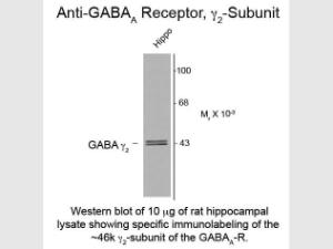 Anti-GABRG2 Rabbit polyclonal antibody