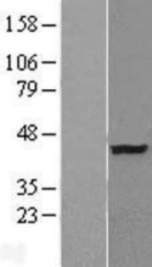 ATP6V0D2 Overexpression Lysate (Adult Normal), Novus Biologicals (NBL1-07835)