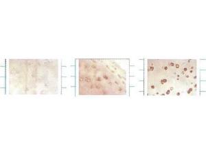 Anti-SOD3 Mouse monoclonal antibody [clone: 4GG11G6]