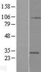 ATP6V1E2 Overexpression Lysate (Adult Normal), Novus Biologicals (NBL1-07844)