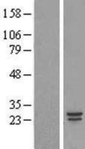 COMMD5 Lysate (Adult Normal), Novus Biologicals (NBP2-09859)
