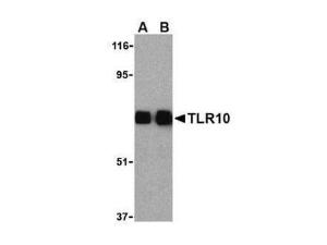 Anti-TLR10 Rabbit polyclonal antibody