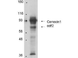 Anti-ODF2 Rabbit polyclonal antibody