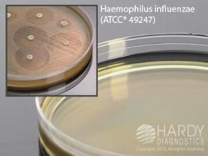 HTM Agar (Haemophilus Test Medium) for susceptibility testing, Hardy Diagnostics