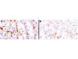 Anti-MSLN Mouse monoclonal antibody [clone: MN-1]