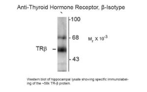 Anti-THRB Mouse monoclonal antibody [clone: 2386]