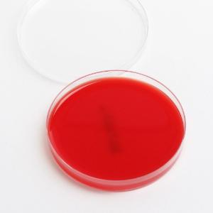 Anaerobic Blood Agar, Plates, Northeast Lab Services