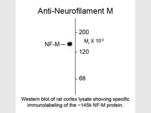 Anti-NEFM Chicken polyclonal antibody