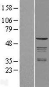 Coatomer Subunit Delta Overexpression Lysate (Adult Normal), Novus Biologicals (NBL1-07646)