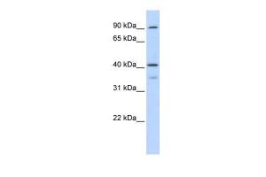 Antibody used in WB on Transfected 293T at 0.2-1 µg/ml.