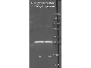 N-acylmanosamino-1-Dehydrogenase Polyclonal Antibody-Western blot