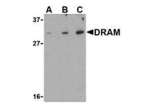 Anti-DRAM Rabbit polyclonal antibody