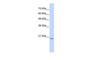 Antibody used in WB on Transfected 293T at 0.2-1 µg/ml.