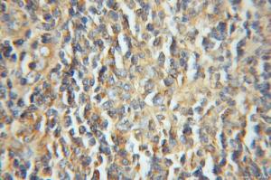 Anti-LIAS Rabbit Polyclonal Antibody