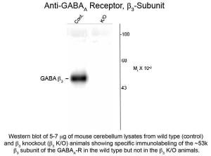 Anti-GABRB3 Rabbit polyclonal antibody