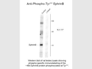 Anti-EPHB2 Rabbit polyclonal antibody