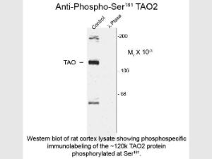 Anti-TAOK2 Rabbit polyclonal antibody