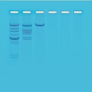 Analysis Of Restriction Enzyme Clevage Patterns Of DNA Lab Activity Kit