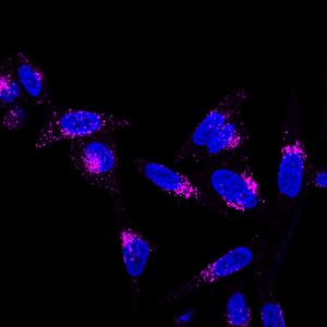 Live HeLa cells stained with LysoView 633 (magenta) and Hoechst (blue).