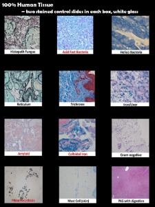 Histology Control Slides, Peroidic Acid Schiff with Digestion (PASD), Springside Scientific
