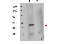 Anti-FKBP8 Rabbit Polyclonal Antibody