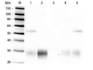 Anti-IgG Goat polyclonal antibody (TRITC (Tetramethylrhodamine Isothiocyanate))