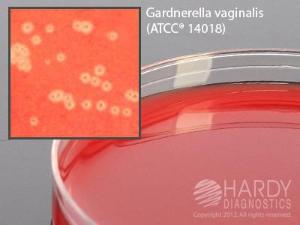 V Agar with CNA, selective for&nbsp;<i>Gardnerella vaginalis</i>