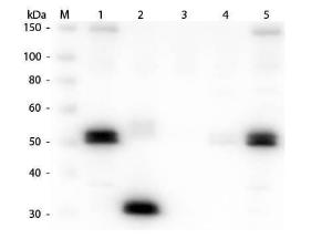 Anti-IgG Goat polyclonal antibody (TRITC (Tetramethylrhodamine Isothiocyanate))