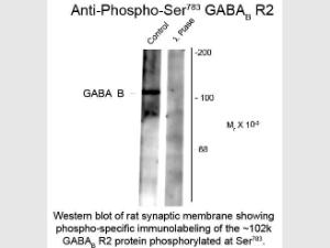 Anti-GABBR2 Rabbit polyclonal antibody