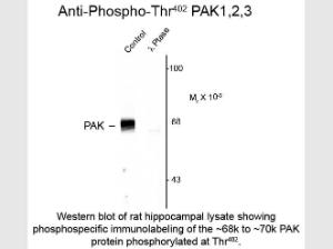 Anti-PAK1 Rabbit polyclonal antibody