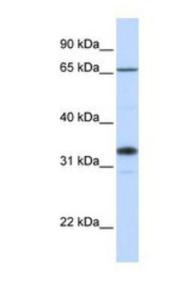 Ago2/eIF2C2 Overexpression Lysate (Adult Normal), Novus Biologicals (NBL1-10183)