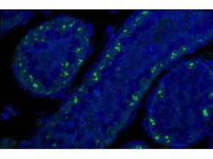 Anti-CDKN2A Rat Polyclonal Antibody [clone: 5.C3.1]