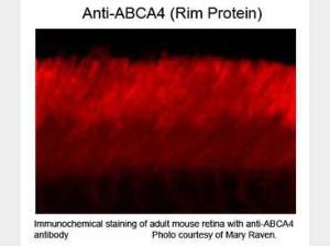 Anti-ABCA4 Mouse monoclonal antibody [clone: 3F4]