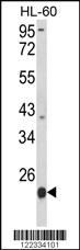 Anti-PSMB9 Rabbit Polyclonal Antibody