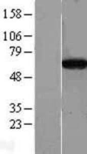 CPNE4 Overexpression Lysate (Adult Normal), Novus Biologicals (NBL1-09443)