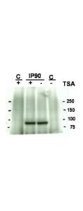 Immunohistochemistry - Anti-Hsp90 Acetyl K294 Antibody