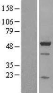 BAG5 Overexpression Lysate (Adult Normal), Novus Biologicals (NBL1-07903)