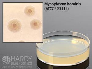 A8 Agar for Mycoplasma, Hardy Diagnostics