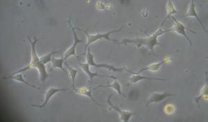 Human iPSC-derived Astrocytes (type 1 or II)