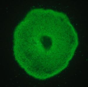 Human iPSC-derived Kidney Proximal Tubules and Podocyte 3D Spheroids